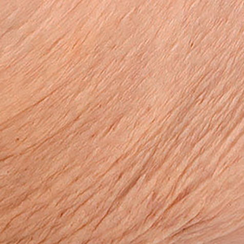 Loose Skin treatment options at SF Bay Cosmetic Surgery Medical Group in San Ramon