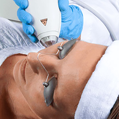 Treat Melasma with our Clear + Brilliant® at SF Bay Cosmetic Surgery Medical Group in San Ramon