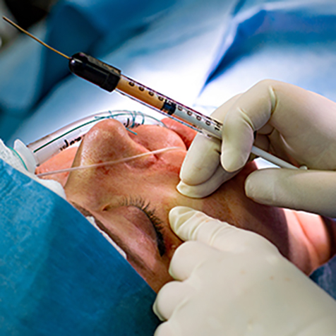 Treat wrinkles with our Facial Rejuvenation at SF Bay Cosmetic Surgery Medical Group in San Ramon