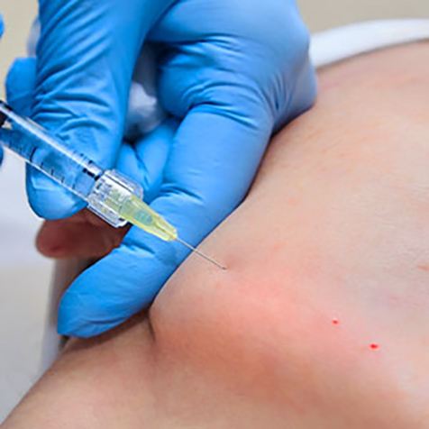 Treat Double Chin with our Kybella® at SF Bay Cosmetic Surgery Medical Group in San Ramon